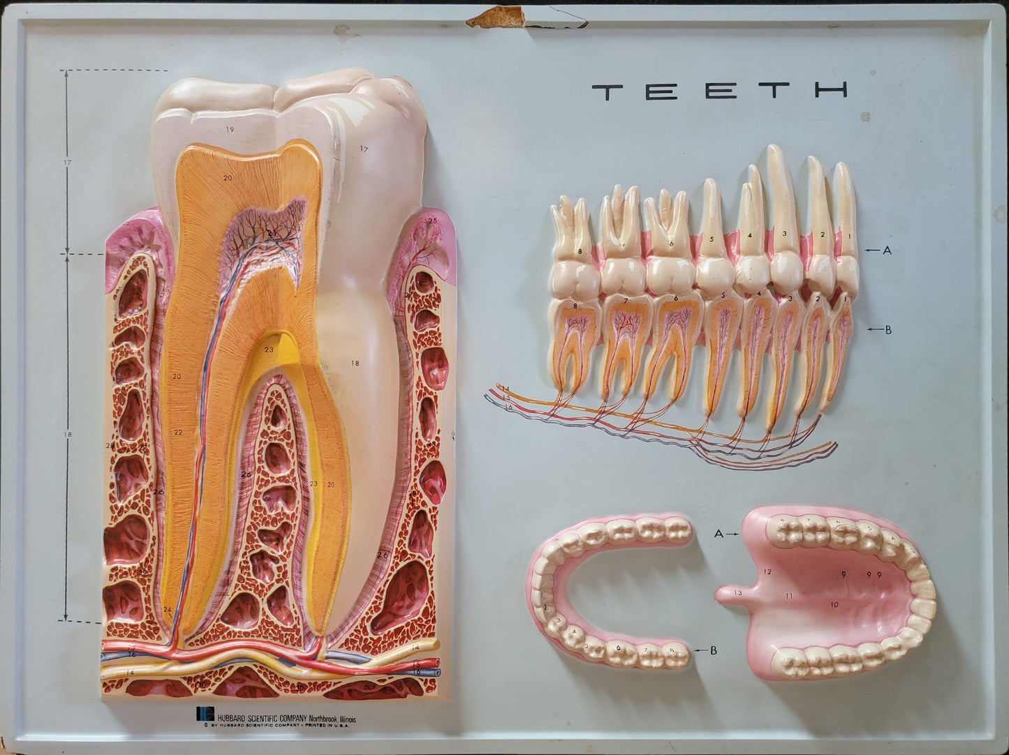 Hubbard 3D Scientific Model 1967 TEETH